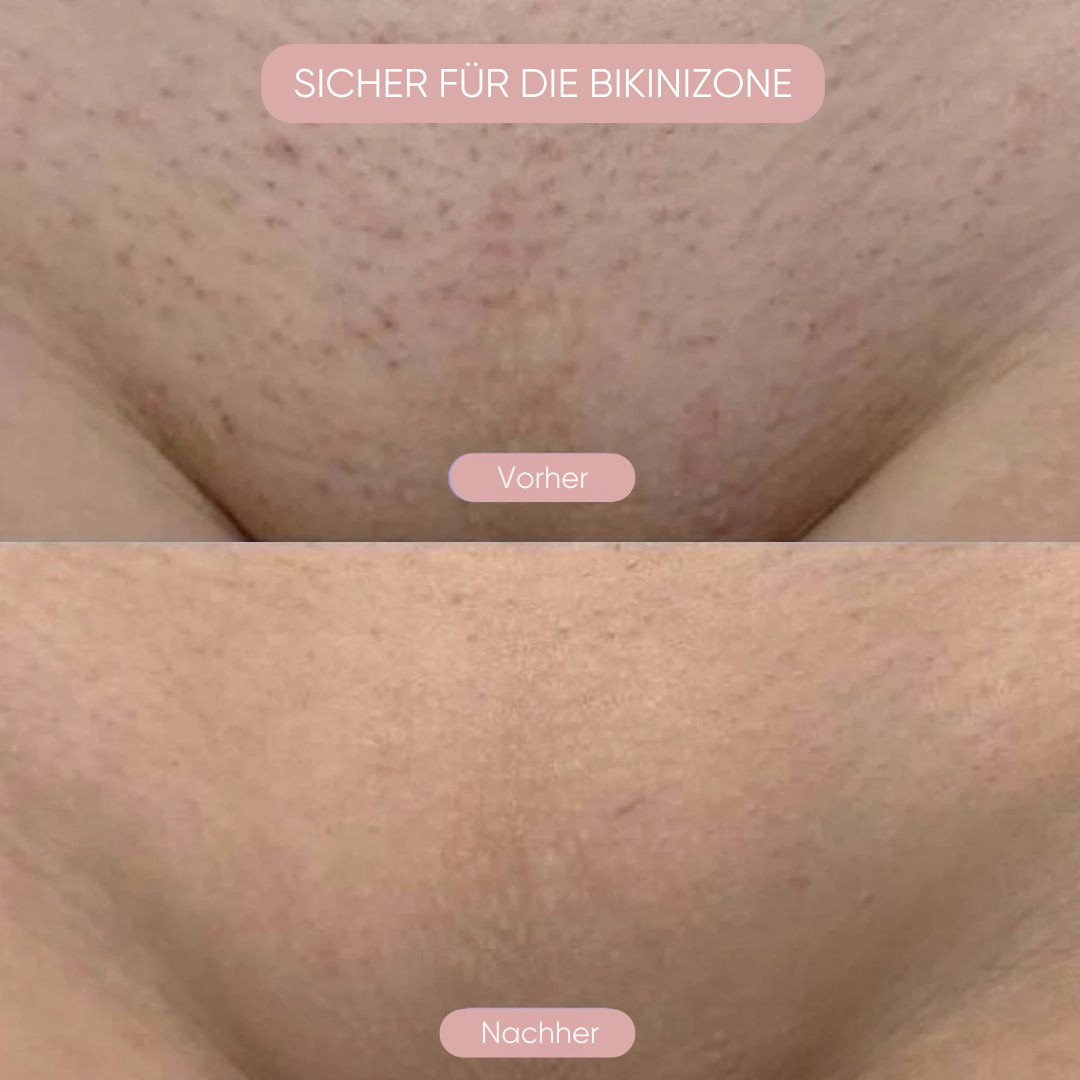 Intimrasierer 5-in-1